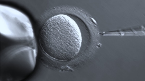 Ovocito humano con Zona pelúcida, fertilización in vitro (FIV) y tecnología de reproducción asistida (ART) con ZEISS Axio Vert. Imagen vía Flickr, por Zeiss Microscopy