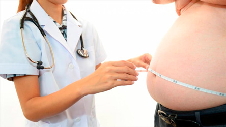 Santa Cruz, departamento con más casos de obesidad en el país