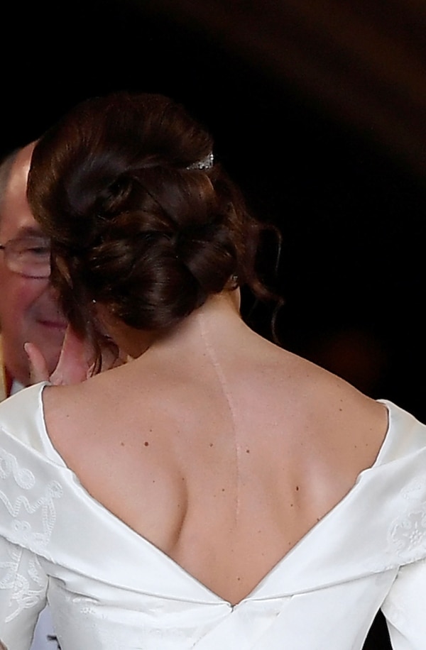 La impactante cicatriz de la princesa Eugenie que dejo ver el día de su boda