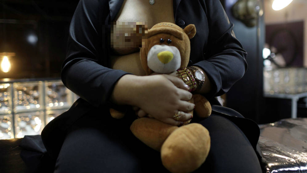 Foto: Una paciente después de ser operada por un cáncer de mama. (Reuters)