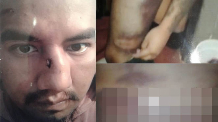 Pari herido Pari herido