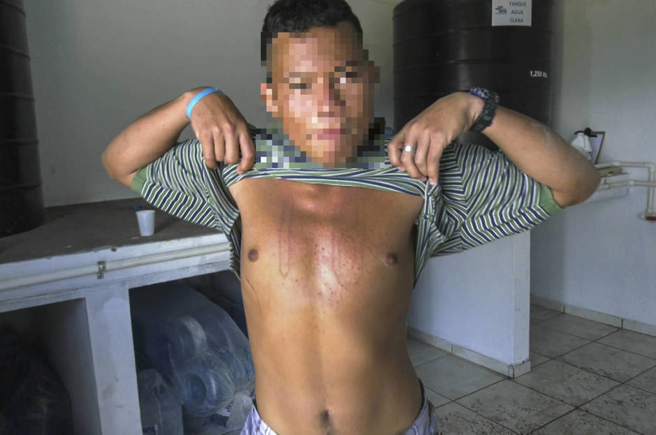 Noel muestra las cicatrices de sus torturas a manos de la mara. (A. Sáez)