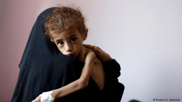 Hungersnot im Jemen (Reuters/K. Abdullah )