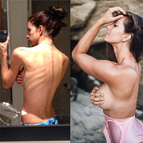 El antes y después de Janna (@jannabreslin)