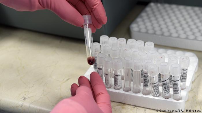 Argentinien Universität Buenos Aires | Forschung HIV (Getty Images/AFP/J. Mabromata)