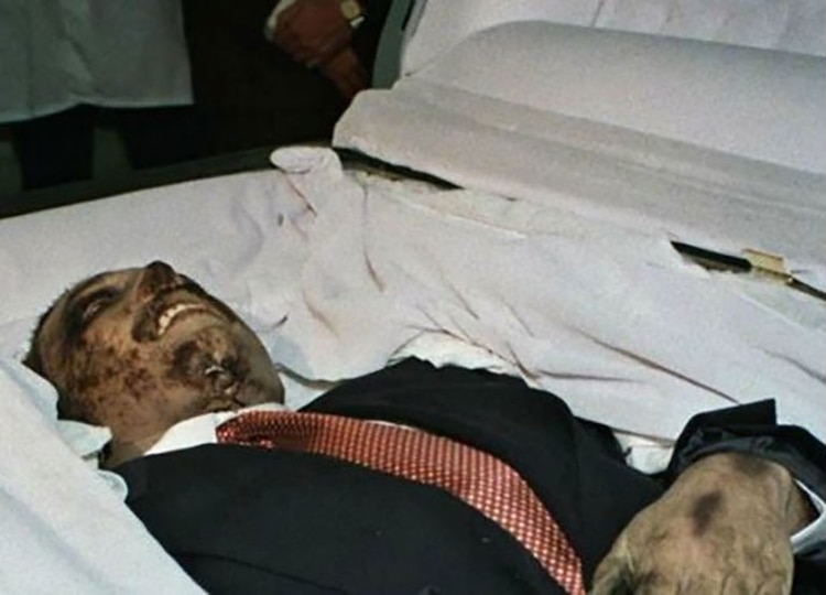 El cuerpo del afamado capo luego de la fallida cirugía (Foto: Archivo)