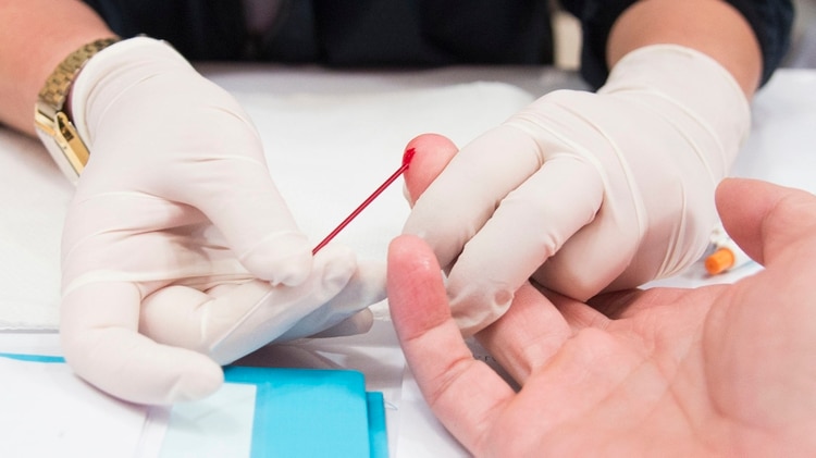 En 10 minutos y con sólo una gota de sangre se puede hacer el testeo de VIH (Getty Images)
