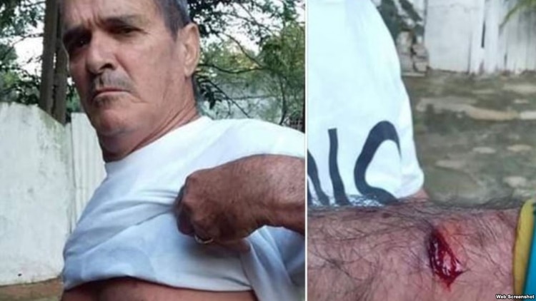 José Díaz Silva fue agredido cuando intentaba llegar a su colegio electoral y ejercer su derecho al voto