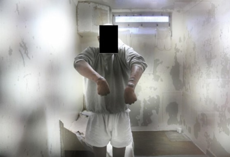 Un recluso en confinamiento solitario le mostró al investigador las lesiones que se provocó a sí mismo en momentos de desesperación (Craig Haney)