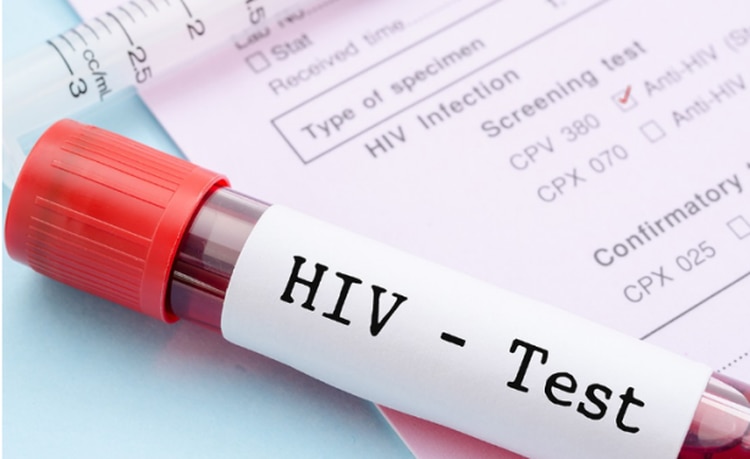 Para terminar con los contagios de VIH en 10 años en los EEUU se requiere más que ciencia.
