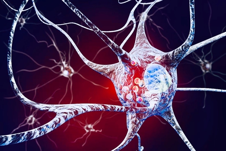 “No hay evidencia científica de que (con cannabis) mejore el Parkinson (Foto: Archivo)