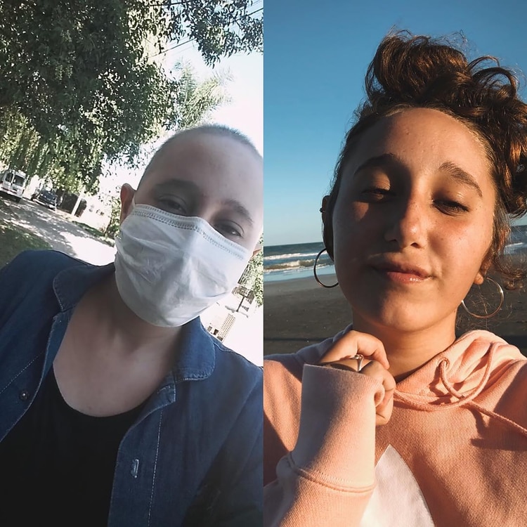 A la izquierda, cuando estaba en pleno tratamiento, y a la derecha, hoy, ya recuperada de la enfermedad.