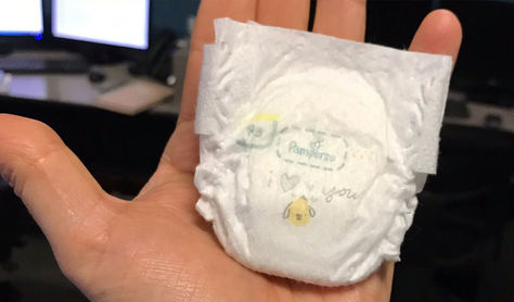 El pañal que la bebé Saybie debe utilizar por su pequeña talla.