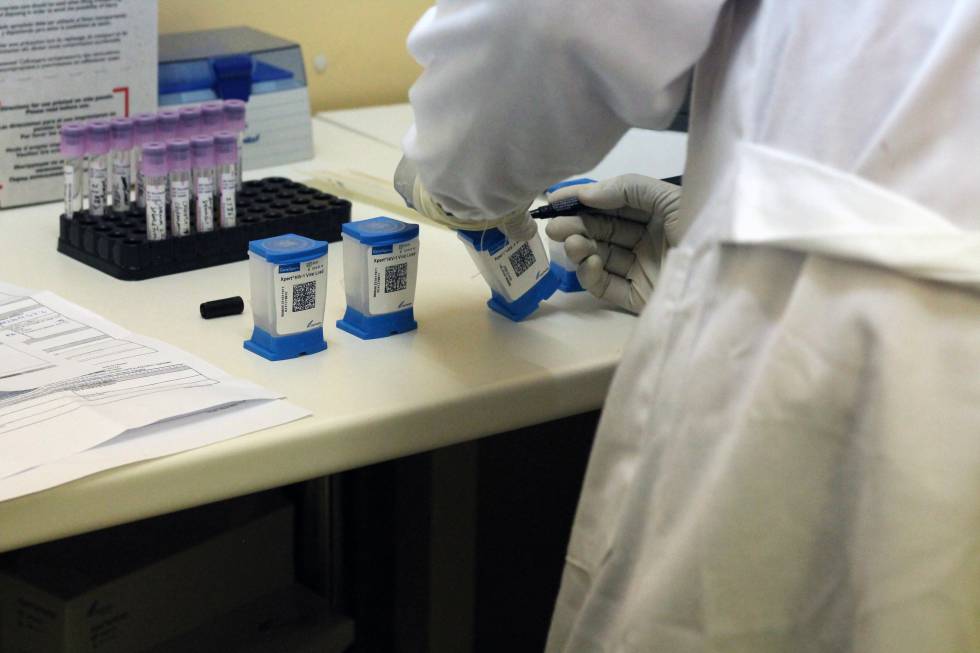 Técnicos del laboratorio del CRAM realizando un prueba de VIH.