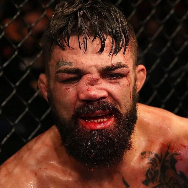 Así quedó el rostro de Mike Perry (@Player1USA)
