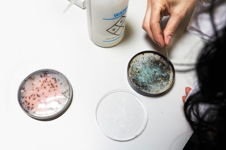 Las pruebas siguen avanzando para generar una vacuna exitosa Foto: (George Bernard / Science Source)