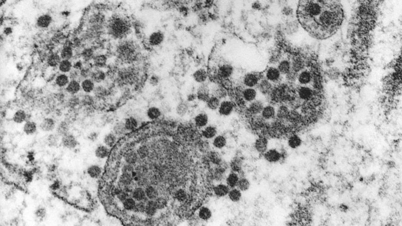 Tres muertes lleva en EE.UU. el raro virus trasmitido por mosquitos que afecta el cerebro
