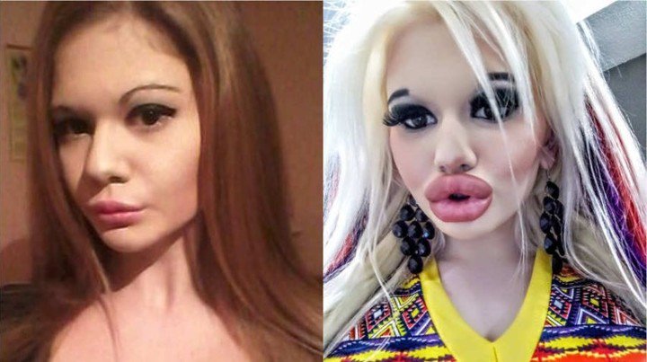 El antes y el después de Andra (Instagram).