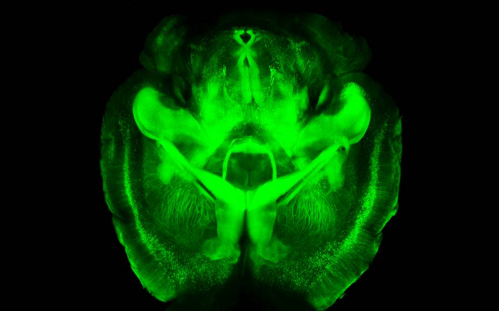 cerebro humano