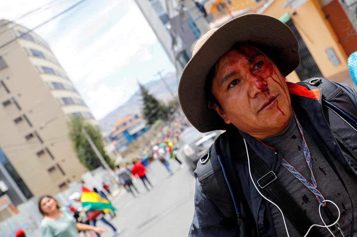 Un hombre resultó herido en su rostro durante los violentos enfrentamientos en La Paz (REUTERS/Kai Pfaffenbach)
