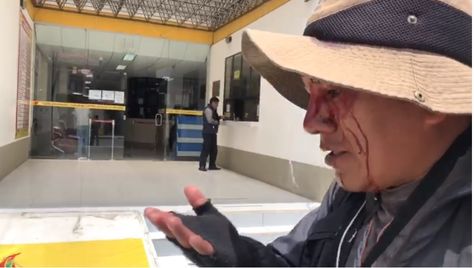El fotógrado de La Razón, Miguel Carrasco, fue herido durante su cobertura de las movilizaciones en La Paz.