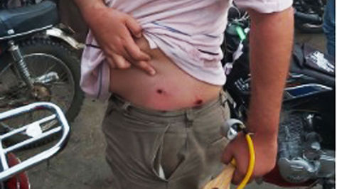 Una persona con impacto de un perdigón en Portachuelo, Montero.