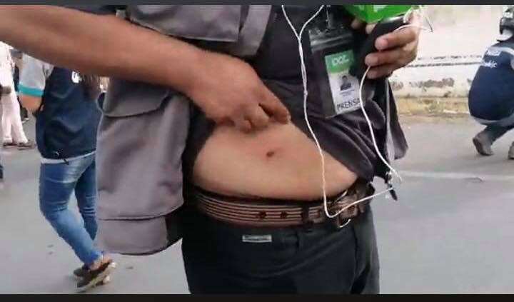  El periodista de PAT, Fernando Bustamante, fue uno de los afectados /Foto: Los Tiempos
