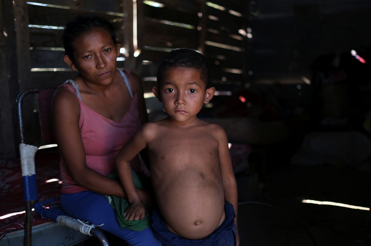 Rosa Rojas y su hijo José María, de 6 años, quien según ella tiene bajo peso para su edad y ha sido diagnosticado con desnutrición, posan para una foto en su casa en Barquisimeto (REUTERS/Carlos García Rawlins)