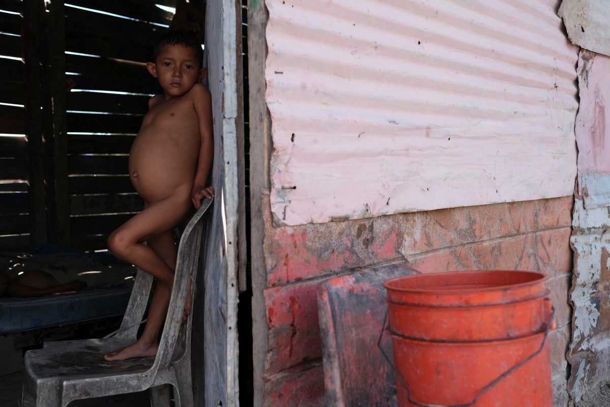 Jose María, de 6 años, mira a la cámara. Sufre de desnutrición (REUTERS/Carlos García Rawlins)