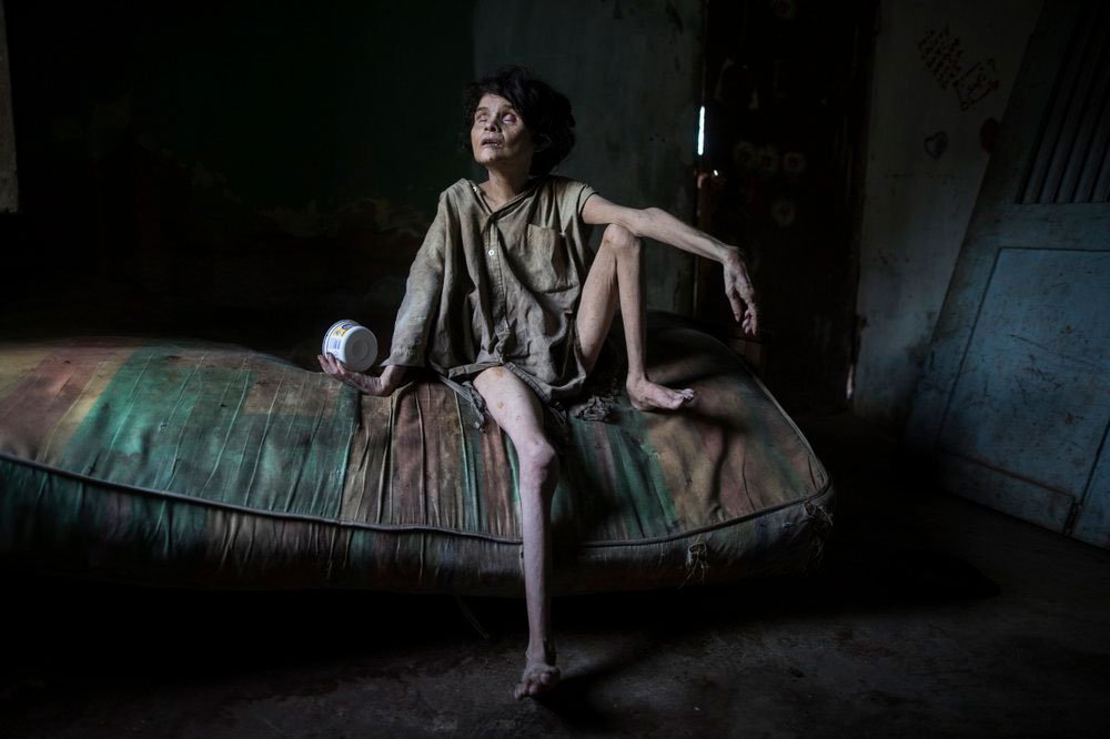 En esta foto publicada el 27 de diciembre del 2019, Zaida Bravo, que sufre del mal de Parkinson y malnutrición, espera por su cena en su habitación en Maracaibo, Venezuela (AP Images)