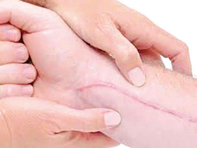 “Cutting”: Preocupan casos en el área rural “Cutting”: Preocupan casos en el área rural