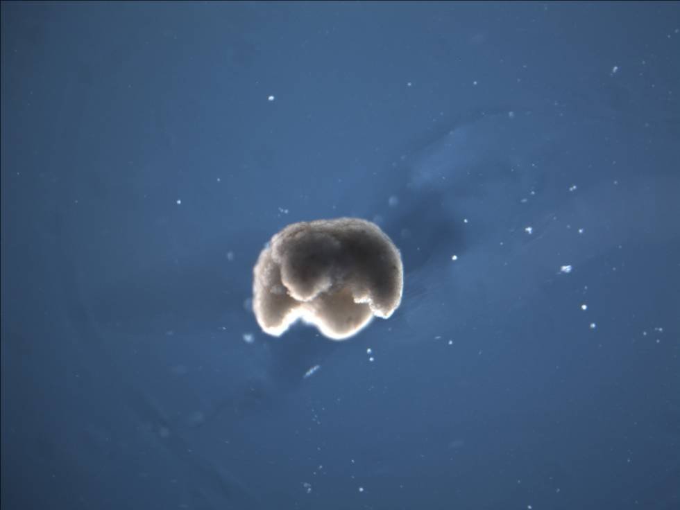 Uno de los biobots de medio milímetro creados por el equipo de Michael Levin y Josh Bongard.