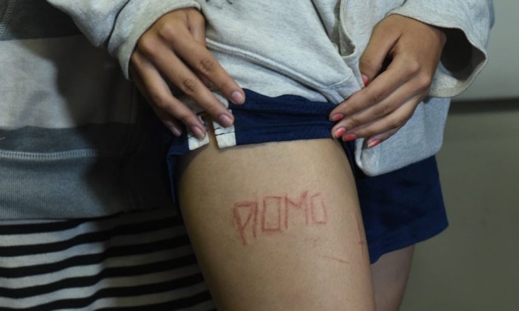 Después de 11 horas de terror dos hermanas fueron dejadas por paramilitares en un carretera, amarradas, golpeadas y una de ellas con la palabra “PLOMO”, que los simpatizantes del régimen usan como sentencia contra los opositores, tatuada en una de sus piernas. (Foto cortesía)