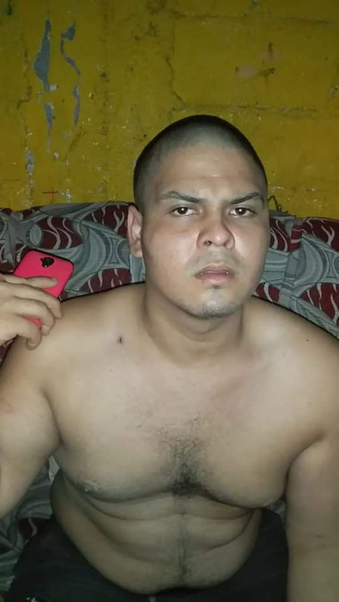 Leonardo Rivas, 23 años, apareció rapado, golpeado y marcado en la espalda, después de seis días que no se sabía de él. (Foto cortesía)