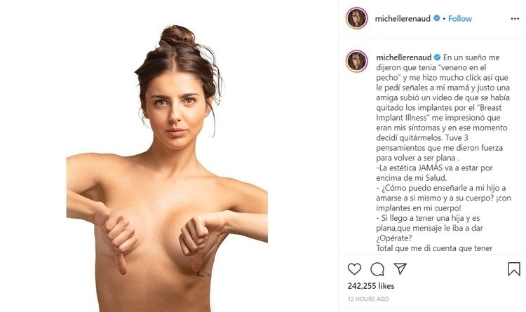 La actriz decidió quitarse los implantes para mejorar su estado de salud. (Foto: Instagram)