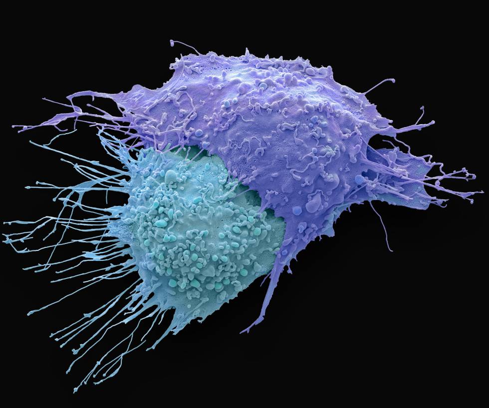 cancer