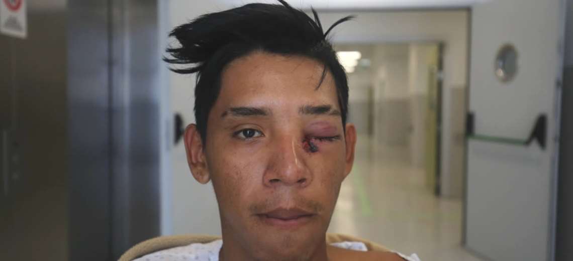 Michel Damián Hurtado, de 18 años, regresaba en bicicleta al local de comidas donde repartía comida cuando fue agredido por los Carabineros | Foto: Cortesía El Mercurio de Antofagasta 