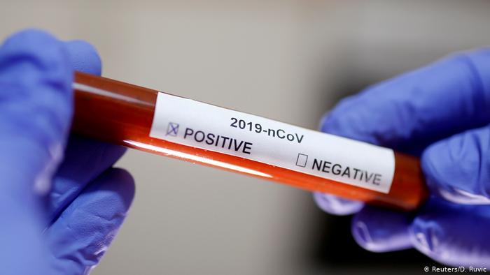 China Coronavirus Symbolbild (Reuters/D. Ruvic)