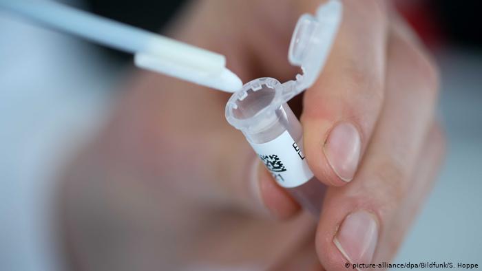 Incluso una prueba negativa no excluye completamente una posible infección de coronavirus (picture-alliance/dpa/Bildfunk/S. Hoppe)