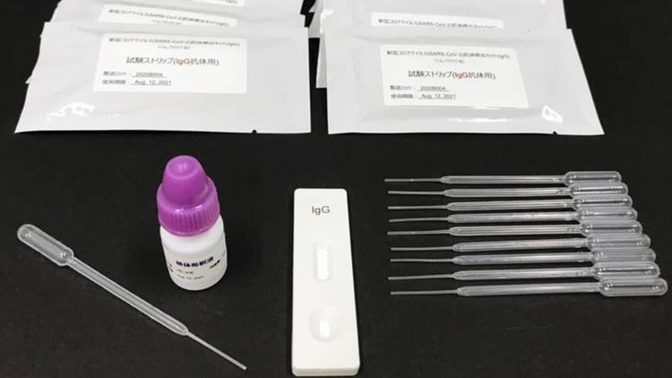 El kit de prueba que lanzará Kurabo Industries Ltd. puede detectar el coronavirus en 15 minutos