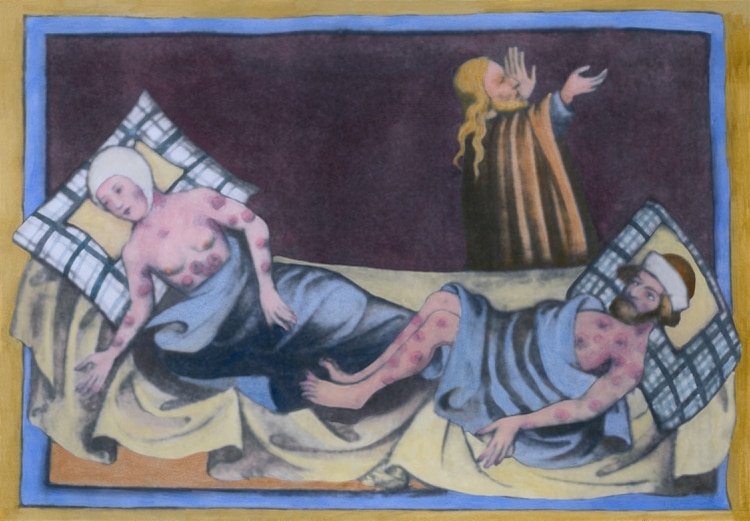 Un hombre y una mujer con la peste bubónica con las características úlceras en sus cuerpos en una pintura medieval de una Biblia de 1411 en Toggenburg, Suiza (Foto: Shutterstock)