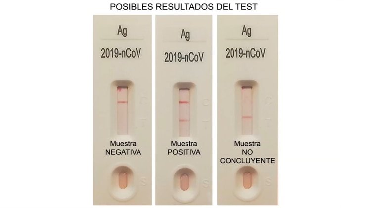 Como este coronavirus tan silencioso como transmisible, hace falta un despliegue masivo de análisis. (Ministerio de sanidad España)