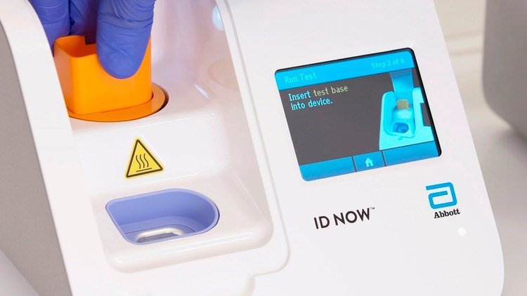 El test puede realizarse fuera de los hospitales