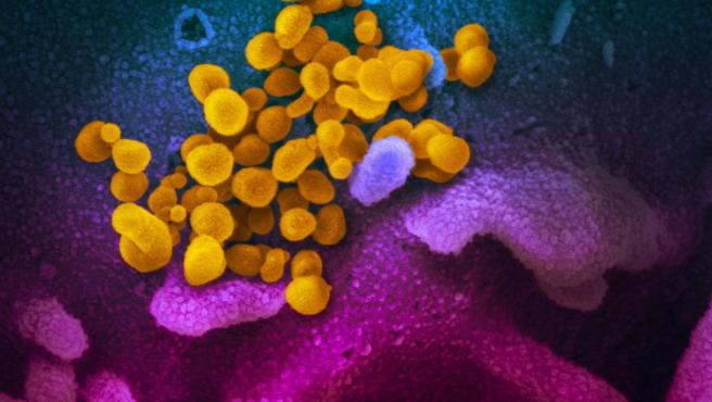 Imagen de microscopio electrónico de barrido muestra SARS-CoV-2 (amarillo), también conocido como 2019-nCoV, el virus que causa COVID-19, aislado de un paciente en los EE. UU. ) cultivados en el laboratorio. Imagen de microscopio electrónico de barrido muestra SARS-CoV-2 (amarillo), también conocido como 2019-nCoV, el virus que causa COVID-19, aislado de un paciente en los EE. UU. ) cultivados en el laboratorio. 17/3/2020