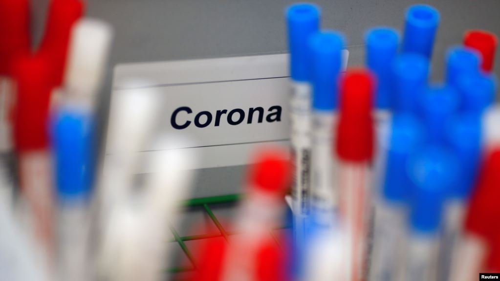 FDA autoriza uso de emergencia de pruebas rápidas para coronavirus Reuters