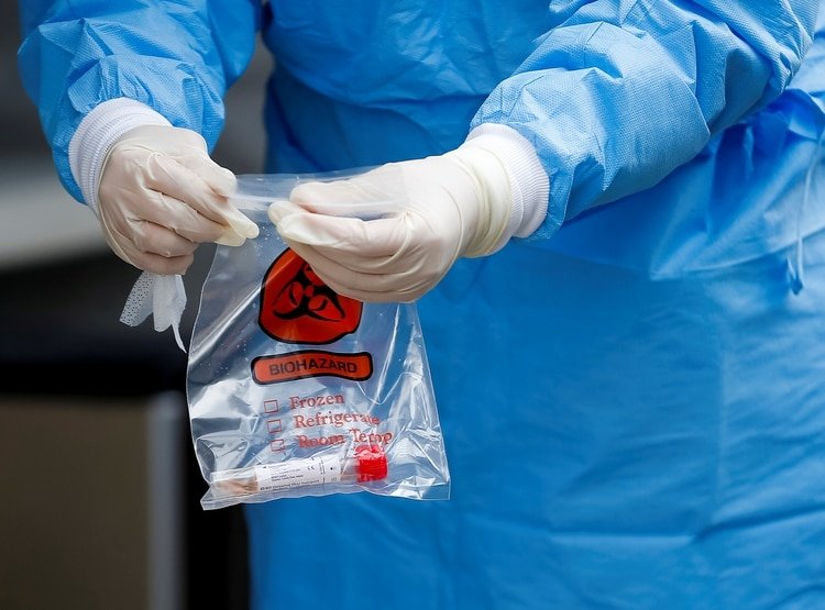 La falta de kits de análisis del nuevo coronavirus y la demora que requiere el resultado causan una pérdida de recursos escasos. (REUTERS/Lindsey Wasson)