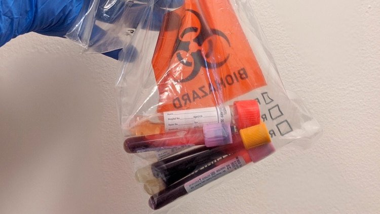 El plasma de la sangre de los donantes podría servir para crear un tratamiento contra el COVID-19 (@GusoffTV)