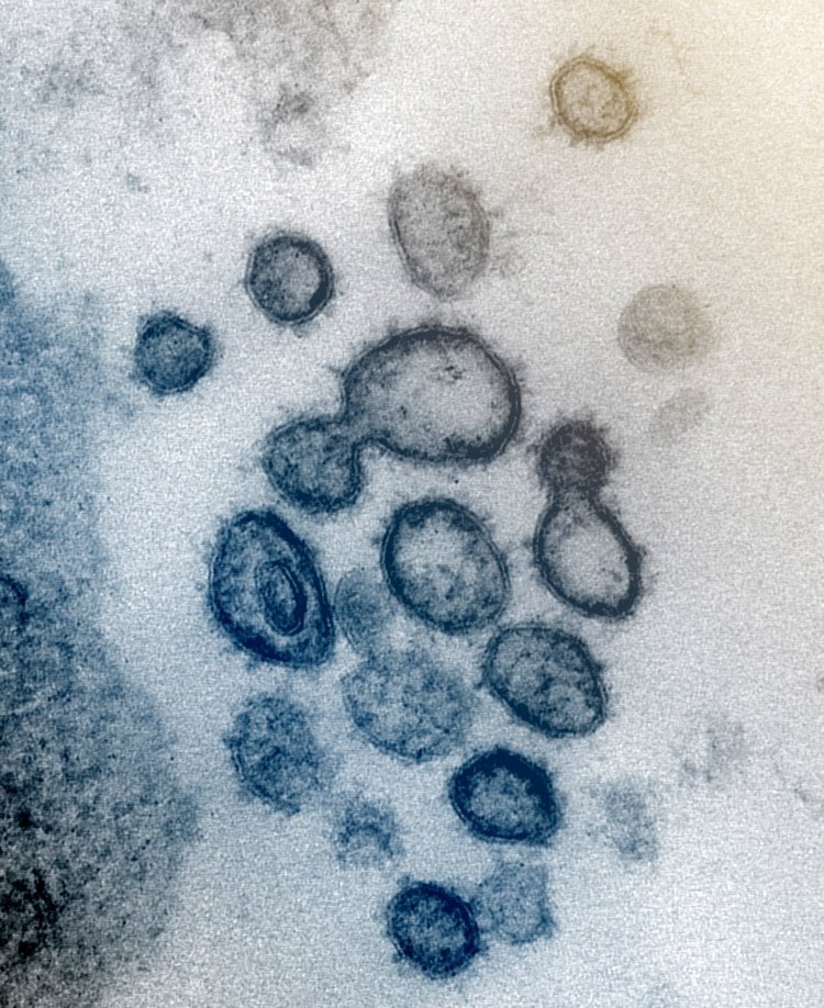 Los picos en el borde exterior de las partículas del virus le dan a los coronavirus su nombre, parecido a una corona. (NIAID-RML/Handout vía REUTERS)