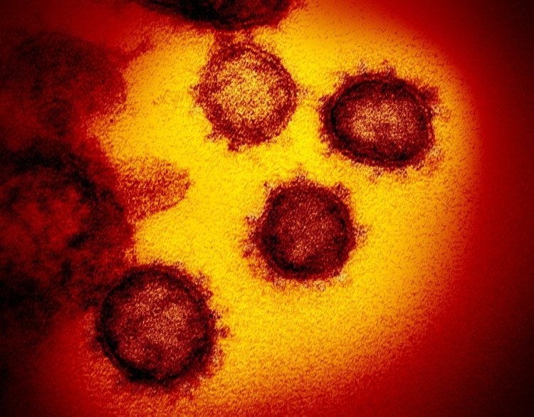 Imagen microscópica del nuevo coronavirus (NIAID-RML/Handout via REUTERS)