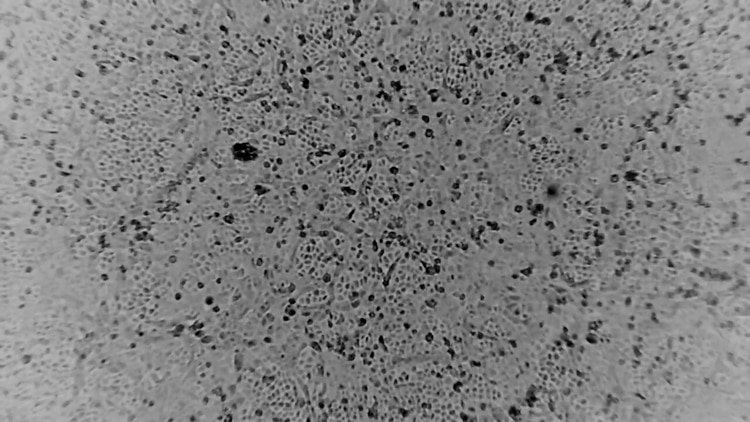 Una imagen fija tomada de un video muestra al coronavirus creciendo en las células Vero E6, en Melbourne, Australia (Dr. Julian Druce - Vidrl, The Doherty Institute via REUTERS)